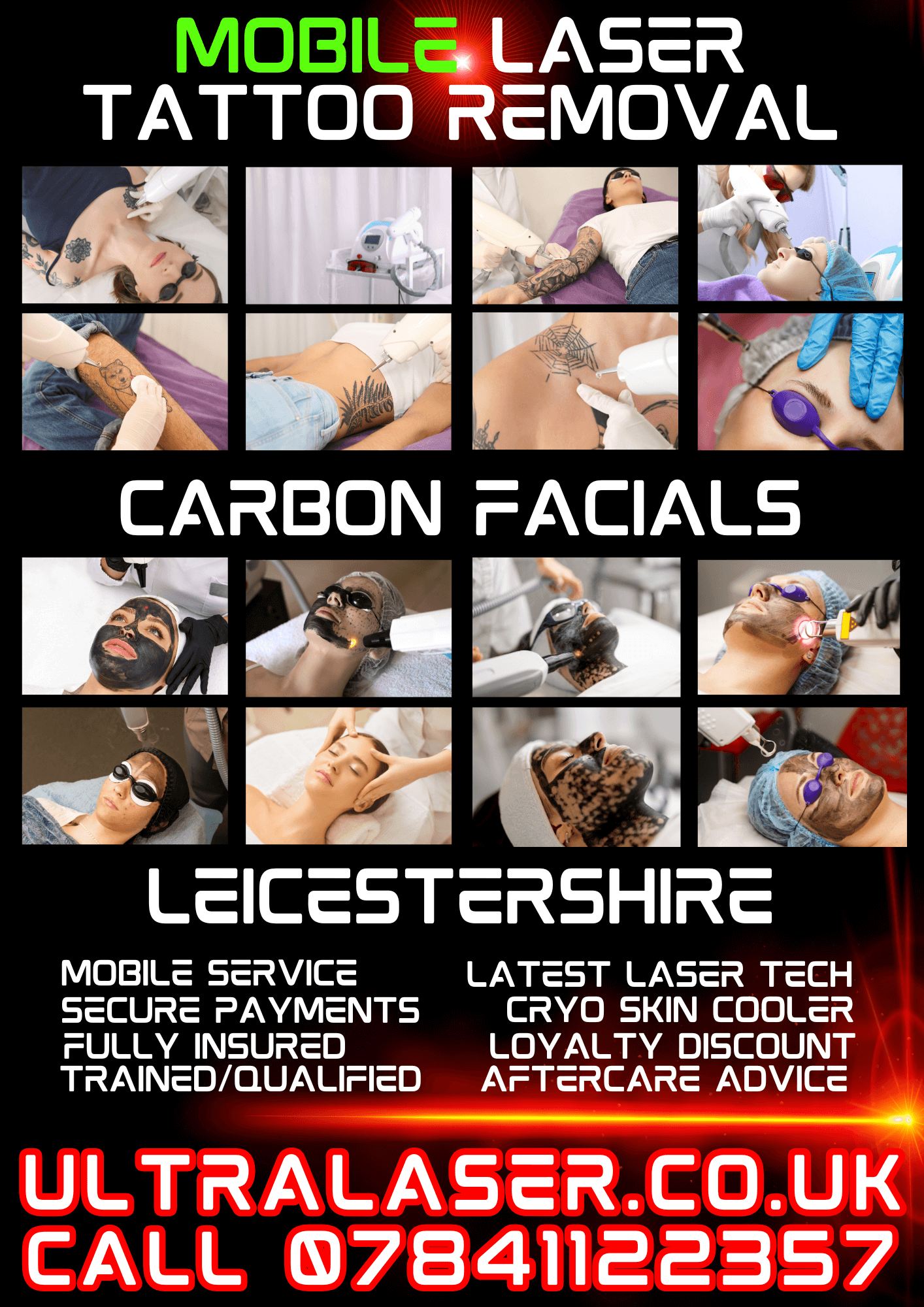 Mobile Tattoo Removal Hinckley