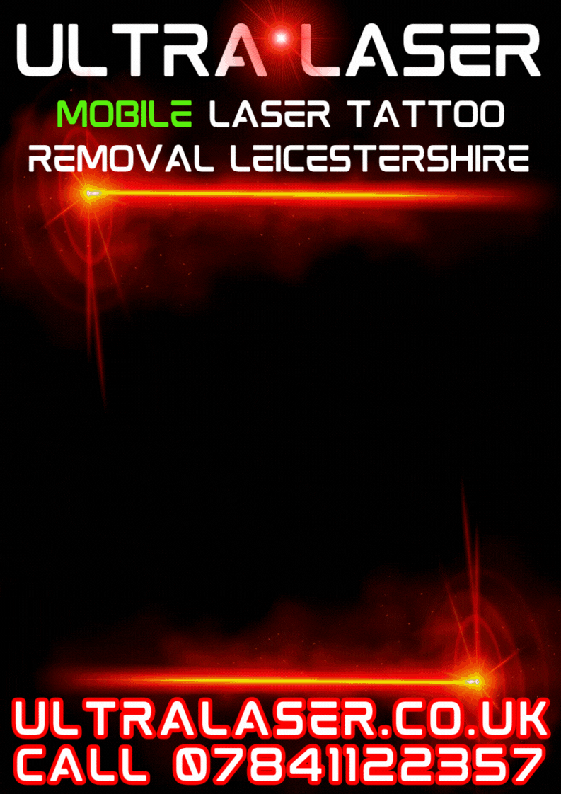 mobile tattoo removal nuneaton