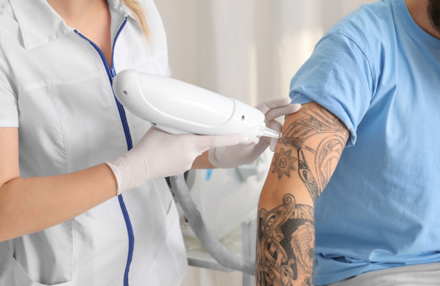 Mobile Tattoo Removal Lichfield