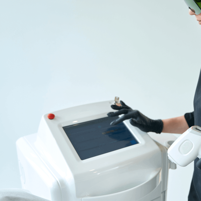 mobile tattoo removal coventry