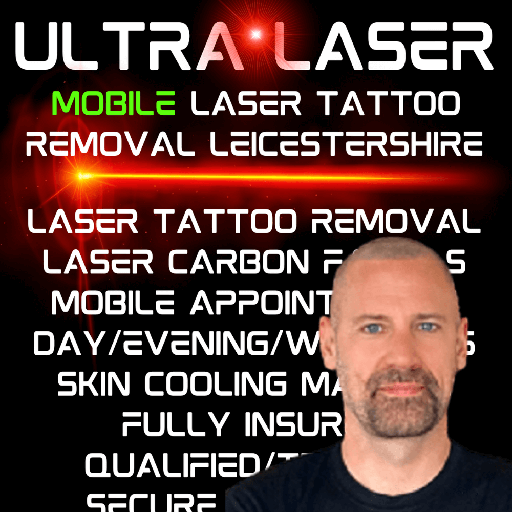 mobile tattoo removal leicester
