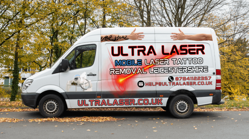 Mobile Tattoo Removal Nuneaton